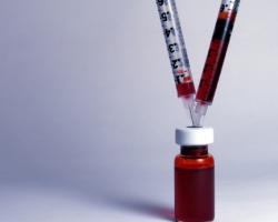 anorexia nervosa blood tests